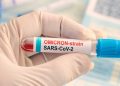 Mad Scientists Create Coronavirus With 80% Lethality in Mice