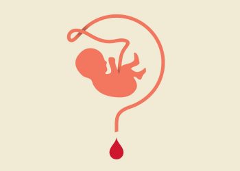 Is Cord-Blood Banking Worth It?