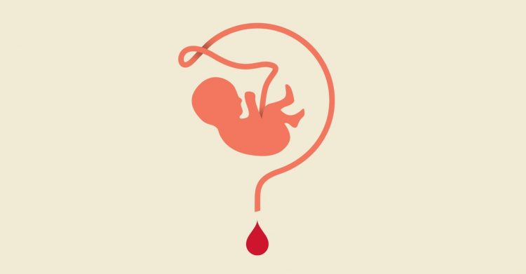 Is Cord-Blood Banking Worth It?