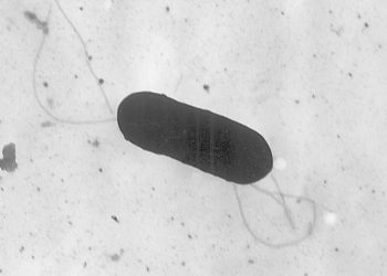 Listeria Outbreak in Deli Meat Kills One and Sickens 16: CDC