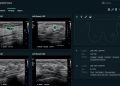 Medtech startup See-Mode gets Canada’s nod for AI breast, thyroid ultrasound analysis software