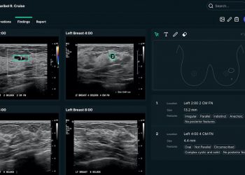 Medtech startup See-Mode gets Canada’s nod for AI breast, thyroid ultrasound analysis software