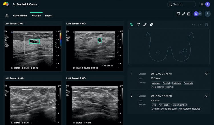 Medtech startup See-Mode gets Canada’s nod for AI breast, thyroid ultrasound analysis software
