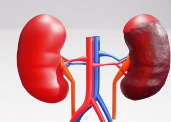 The Latest Kidney Cancer Treatment Advances: What to Know