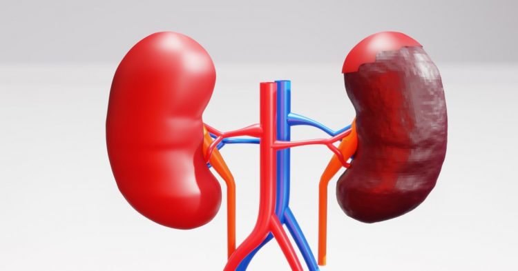 The Latest Kidney Cancer Treatment Advances: What to Know